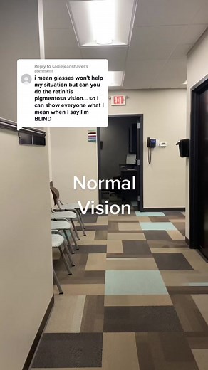 Understanding Retinitis Pigmentosa Vision: A Simulation