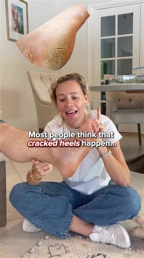 Epsom-It on Instagram: "Why do you have cracked heels and how to solve the issue! 🦶#feet #crackedheels"