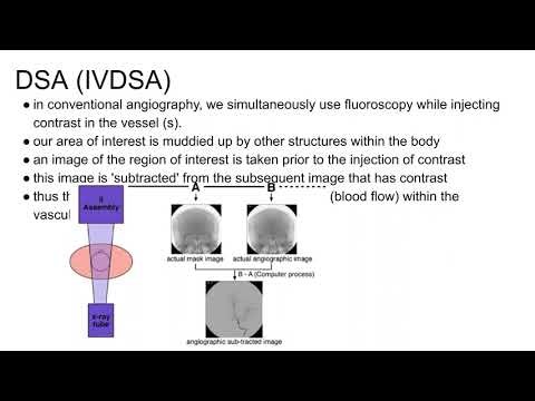 Diagnostic Interventional Angiography for Peripheral Arterial Occ
