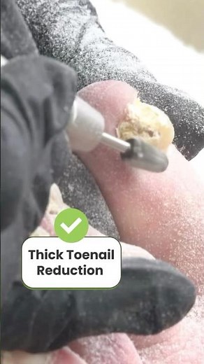 Look at these thick toenails👀 now we just exfoliate and smooth! #footcare