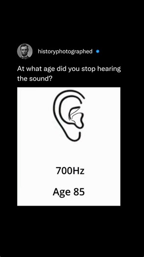 936K views · 2.7K reactions | Age-related hearing loss, or presbycusis, is a common part of growing older. It often begins with difficulty hearing high-pitched sounds or following conversations in noisy places. Caused by changes in the inner ear or reduced blood flow, it can be managed with early detection and hearing aids to improve daily life. | History In Pictures | Facebook