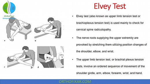 Elvey Test | Upper Limb Tension Tests (ULTTs) Overview 2025