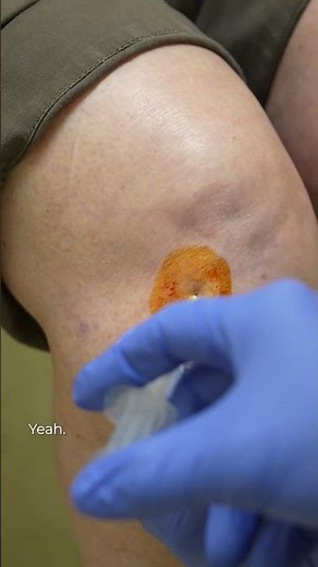 What to Expect from a Cortisone Injection for Knee Pain | Step-by-Step with Dr. Green