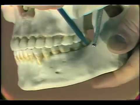 Dental Anatomy Introduction
