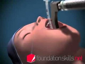 Endotracheal Intubation Animated
