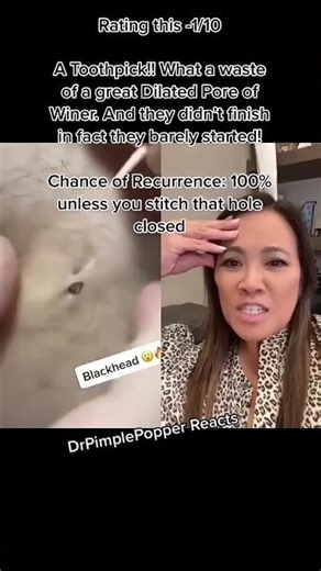 Blackhead vs Toothpick!!!