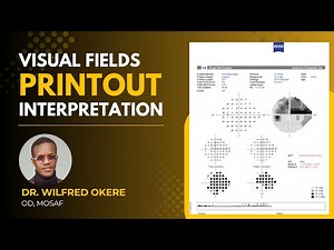 Visual Field Printout Interpretation | Full Tutorial on CVF Analysis