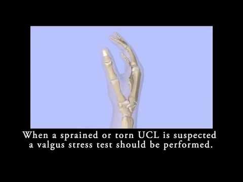 Stress Test of the Ulnar Collateral Ligament of the Thumb