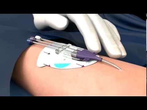 3M™ PICC / CVC Securement System Application and Removal | 3M Critical & Chronic Care Solutions