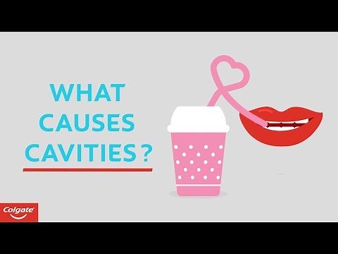 What Causes Cavities | Colgate®