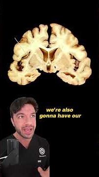 Anatomy of the Brain - Coronal Dissection | Can you identify this structure? | Med School Bootcamp