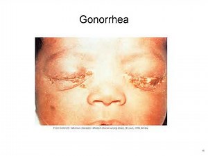 Reproductive System Disorders Explained: STDs, Infertility, Cancers, and Pregnancy Complications