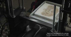 Brain of famous amnesiac "H.M." yields new insights into memory