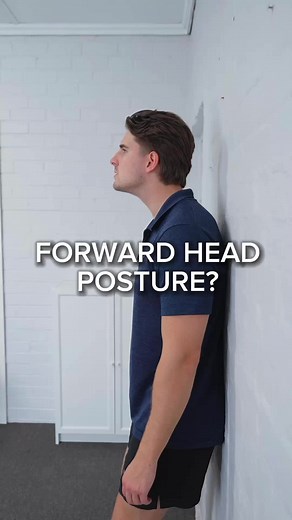 Neck Posture Fix Exercise to Improve Forward Head Posture