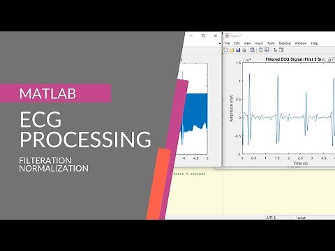 ECG Filtration and Normalization in MATLAB | MATLAB Digital Signal Processing