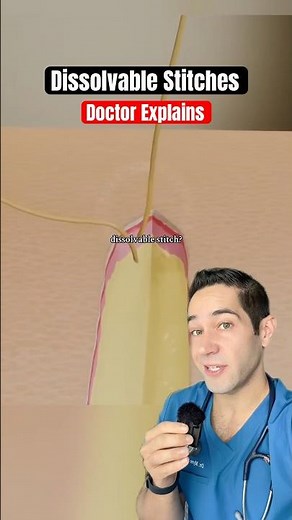 Doctor Explains: dissolvable stitches