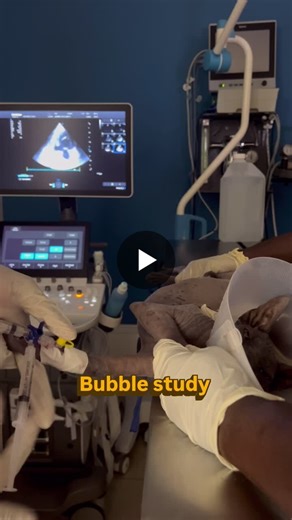 Bubble Study in Echocardiography: A Diagnostic Tool for Intracardiac Shunts | mohamed abdelmonaem posted on the topic | LinkedIn