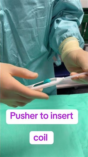 Mirena Coil Explained: Insertion, Benefits & What You Need to Know