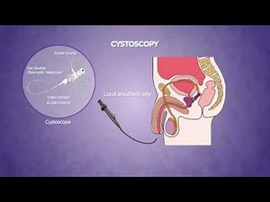 Cystoscopy