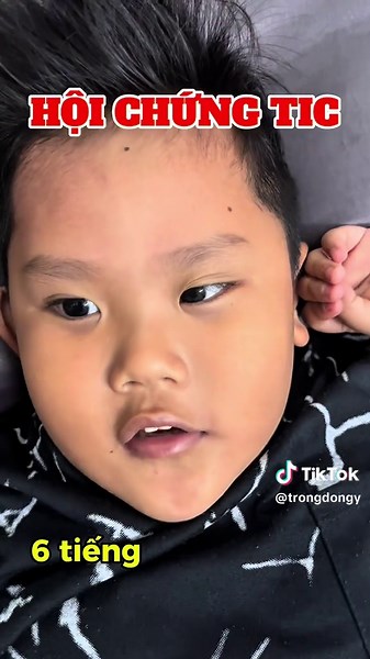 Hội chứng tic #hoichungtic #nhaymat #benhtic