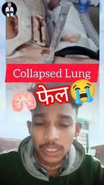 pneumothorax needle decompression