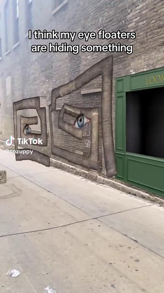 Understanding Eye Floaters: My Experience Explained