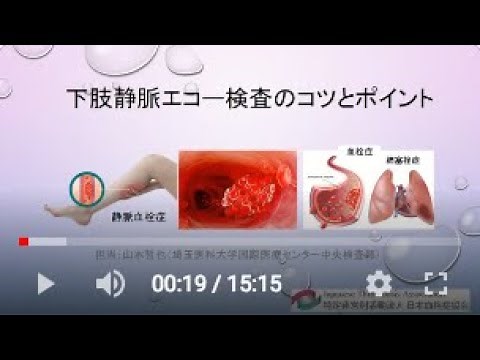 2021年日本血栓症協会市民公開講座医療従事者向け 下肢静脈エコー検査のコツとポイント ワイド画面