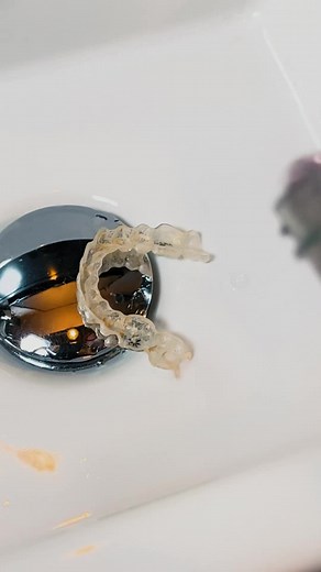 Cleans aligners, retianers, guards and more | retainers