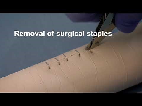Placing and removing surgical wound closure staples