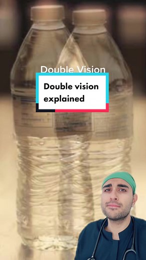 Understanding Diplopia: Causes, Symptoms, and Treatments