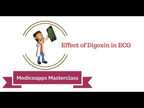 Understanding the Effects on Digoxin on ECG