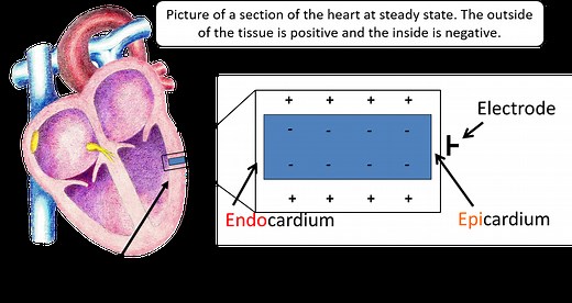 The T-Wave Explained - What Do T Waves On An ECG Represent?