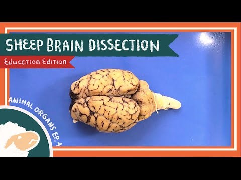 Brain Dissection || Always on My Mind [EDU]