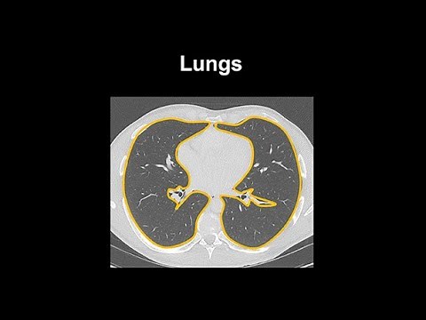 How to identify normal lung anatomy on chest CT