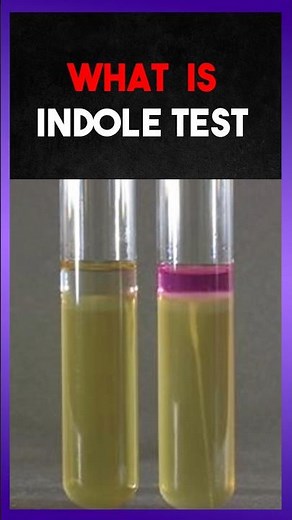 Indole Test | Clear Explain