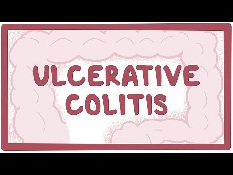 Ulcerative colitis - causes, symptoms, diagnosis, treatment, pathology