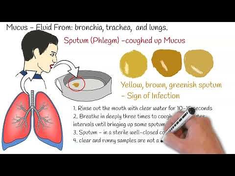 Sputum Test, (Phlegm Analysis), Sputum Culture, Sputum test, Sputum Analysis