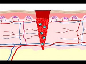 Phases of Tissue Repair and Wound Healing