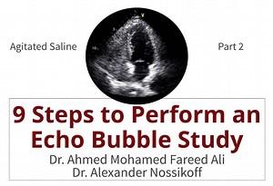 9 Steps to Perform an Echo Bubble Study