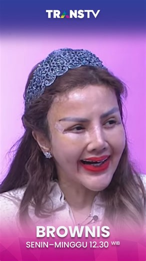 TRANS TV on Instagram: "Barbie Kumalasari ngespill cerita, usai operasi plastik di area mata 👀✨ #brownistranstv #transtv #AL"