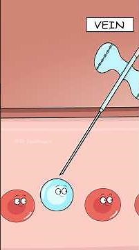 Why IV Drips Work Faster Than Pills? #shorts