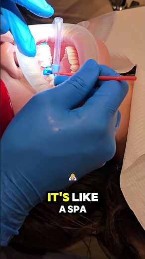 Composite Bonding Step-by-Step