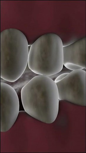 What is Enamel Hypoplasia? (2 Huge Factors Causing it)