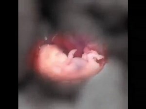 1.6M views · 52K reactions | This is a human being 8 weeks after fertilization, 10 weeks LMP. | Live Action | Facebook