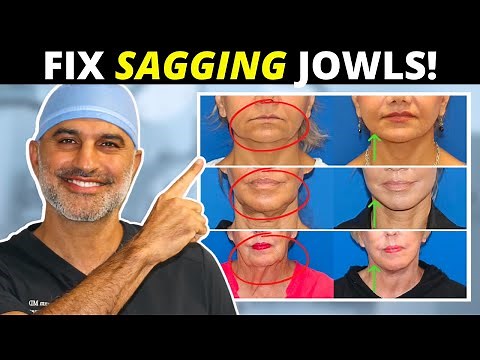 Sagging Jowls 101: How they form and what to do about them! (tighten and eliminate!)