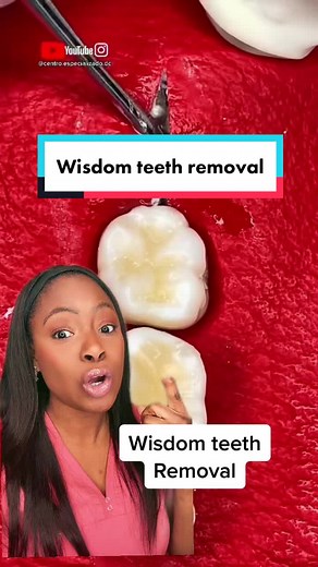 Wisdom Tooth Removal Process Explained: Procedure and Aftercare