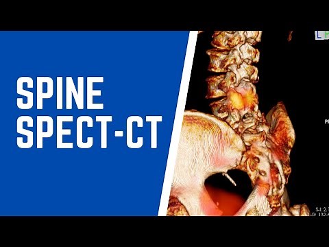 Nuclear Medicine | Bone SPECT-CT | Spine