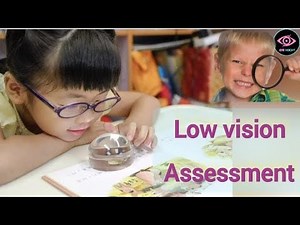 Simple low vision assessment steps |Why we do low vision assessment|