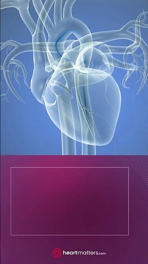 The Coronary Angiogram. #cardiology #angiogram #cardiachealth #heartdisease #anatomy #universe