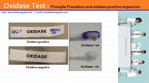 Oxidase Test | Lab Tests Guide
